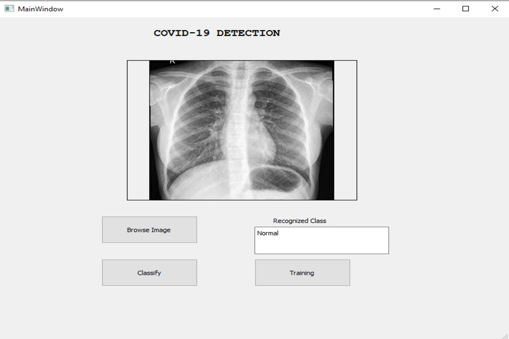 COVID-19 detection deep learning dashboard using TensorFlow and CNN model
